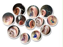 in 12 unterschiedlich großen Kreisen sind verschiedene Ohren dargestellt. Diese haben unterschiedliche Hörhilfen (Hörgeräte oder CI in unterschiedlichen Farben) oder sind ohne Hörhilfe.